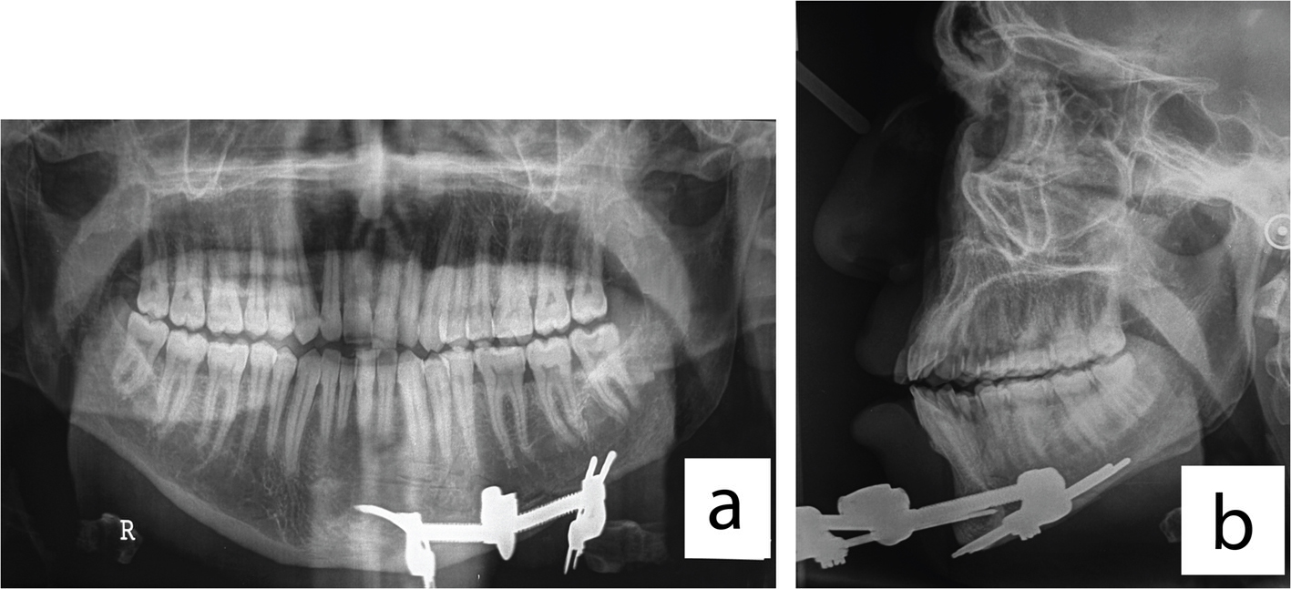 Figure 3. 