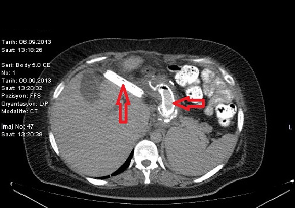 Figure 2. 