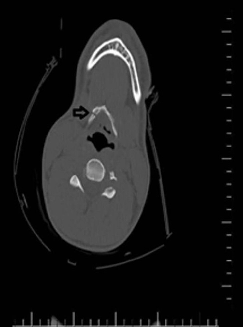 Figure 2. 