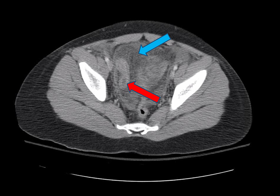 Figure 7. 